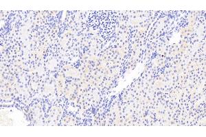 Detection of CSRP1 in Human Kidney Tissue using Polyclonal Antibody to Cysteine And Glycine Rich Protein 1 (CSRP1) (CSRP1 抗体  (AA 1-193))