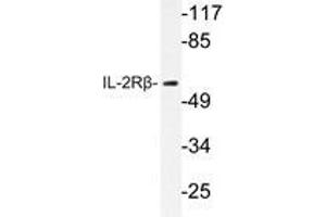 Western blot analysis of IL-2Rβ antibody in extracts from HepG2 cells. (IL2 Receptor beta 抗体)