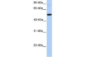 WB Suggested Anti-GALNT13 Antibody Titration:  0. (GALNT13 抗体  (N-Term))