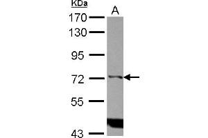 Western Blotting (WB) image for anti-Inositol-Trisphosphate 3-Kinase C (ITPKC) (Internal Region) antibody (ABIN1496062) (ITPKC 抗体  (Internal Region))