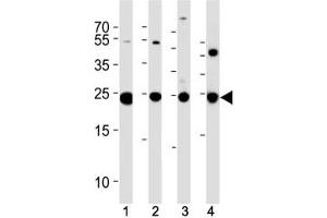Western Blotting (WB) image for anti-Ubiquitin Carboxyl-terminal Esterase L1 (Ubiquitin Thiolesterase) (UCHL1) (AA 187-214) antibody (ABIN3029421)
