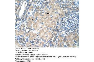 Rabbit Anti-SLC13A3 Antibody  Paraffin Embedded Tissue: Human Kidney Cellular Data: Epithelial cells of renal tubule Antibody Concentration: 4. (SLC13A3 抗体  (Middle Region))