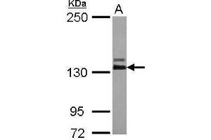 WB Image Sample (30 ug of whole cell lysate) A: IMR32 5% SDS PAGE antibody diluted at 1:1000 (ABL2 抗体  (Center))