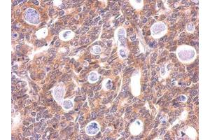 Immunohistochemistry (IHC) image for anti-Microtubule-Associated Protein 1 Light Chain 3 beta (MAP1LC3B) antibody (ABIN2854667)