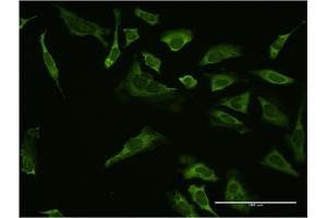 Immunofluorescence of monoclonal antibody to SP1 on HeLa cell. (SP1 抗体  (AA 522-618))