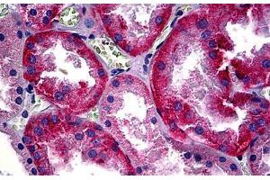 Human Kidney: Formalin-Fixed, Paraffin-Embedded (FFPE) (CD147 抗体)