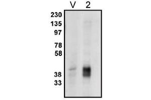 Image no. 1 for anti-Phosphatidic Acid Phosphatase Type 2C (PPAP2C) antibody (ABIN265044) (PPAP2C 抗体)