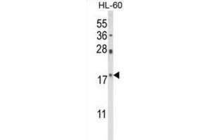 Western Blotting (WB) image for anti-Peptidylprolyl Cis/trans Isomerase, NIMA-Interacting 1 (PIN1) antibody (ABIN3003982) (PIN1 抗体)