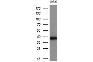 Western Blotting (WB) image for anti-T-cell surface glycoprotein CD1c (CD1C) antibody (ABIN2670676) (CD1c 抗体)