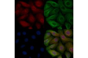 ABIN6255261 and ABIN6267114 staining Heat-shock treated Hela cells by IF/ICC. (EEF2K 抗体  (pSer366))