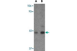 Western blot analysis of TBC1D10C in Daudi cell lysate with TBC1D10C polyclonal antibody  at (A) 1 and (B) 2 ug/mL . (Carabin 抗体  (C-Term))
