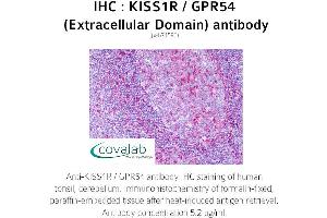Image no. 1 for anti-KISS1 Receptor (KISS1R) (2nd Extracellular Domain) antibody (ABIN1736236) (KISS1R 抗体  (2nd Extracellular Domain))