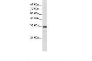 Image no. 2 for anti-U11/U12 SnRNP 35 KDa Protein (AA 29-78) antibody (ABIN203037) (SNRNP35 抗体  (AA 29-78))