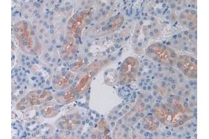 Detection of FTMT in Mouse Kidney Tissue using Polyclonal Antibody to Ferritin, Mitochondrial (FTMT)