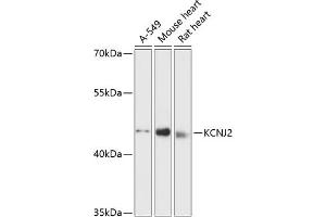 Western Blotting (WB) image for anti-Potassium Inwardly-Rectifying Channel, Subfamily J, Member 2 (KCNJ2) (AA 318-427) antibody (ABIN6142727)