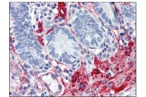Immunohistochemistry (IHC) image for anti-Filamin A, alpha (FLNA) (AA 1-839) antibody (ABIN782404) (Filamin A 抗体  (AA 1-839))