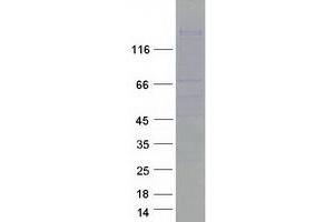 Western Blotting (WB) image for Sperm Associated Antigen 5 (SPAG5) protein (Myc-DYKDDDDK Tag) (ABIN2732490)
