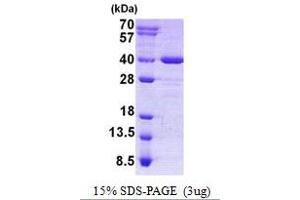Image no. 1 for Axin Interactor, Dorsalization Associated (AIDA) protein (His tag) (ABIN1098551) (AIDA Protein (His tag))