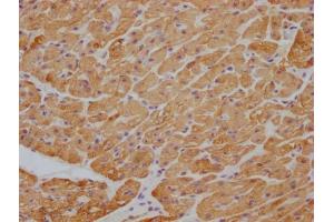 IHC image of ABIN7180354 diluted at 1:100 and staining in paraffin-embedded human heart tissue performed on a Leica BondTM system.