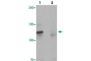 Western blot analysis of TSHZ3 in mouse brain tissue with TSHZ3 polyclonal antibody  at 1 ug/mL in (lane 1) the absence and (lane 2) the presence of blocking peptide.