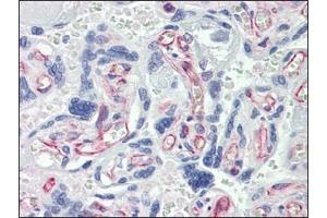 Immunohistochemistry (IHC) image for anti-Caspase 7, Apoptosis-Related Cysteine Peptidase (CASP7) antibody (ABIN614356) (Caspase 7 抗体)