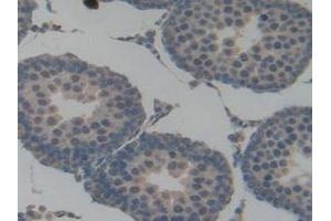 Immunohistochemistry (IHC) image for anti-Plasminogen Activator Inhibitor 1 (SERPINE1) (AA 24-402) antibody (ABIN7431938)
