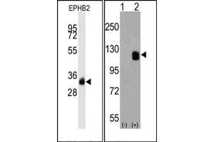 Western Blotting (WB) image for anti-EPH Receptor B2 (EPHB2) antibody (ABIN356401) (EPH Receptor B2 抗体)