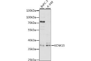 Western blot analysis of extracts of various cell lines, using KCNK15 antibody (ABIN7269466) at 1:1000 dilution. (KCNK15 抗体  (AA 200-300))