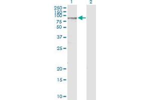 Western Blotting (WB) image for anti-ATP-Binding Cassette, Sub-Family D (Ald), Member 1 (ABCD1) (AA 1-745) antibody (ABIN513234)