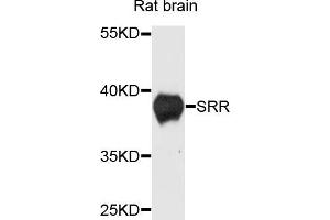 Western blot analysis of extracts of rat brain cells, using SRR antibody. (SRR 抗体)