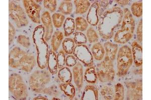 IHC image of ABIN7127638 diluted at 1:100 and staining in paraffin-embedded human kidney tissue performed on a Leica BondTM system. (Recombinant NDUFS3 抗体)