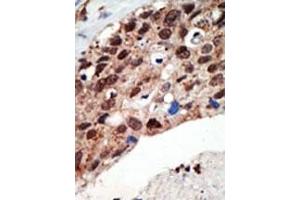 Image no. 1 for anti-SET Domain Containing (Lysine Methyltransferase) 7 (SETD7) (Middle Region) antibody (ABIN356694) (SETD7 抗体  (Middle Region))