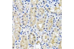 Immunohistochemistry (Paraffin-embedded Sections) (IHC (p)) image for anti-Synaptosomal-Associated Protein, 29kDa (SNAP29) (AA 1-258) antibody (ABIN1682838)