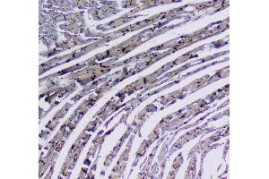 Immunohistochemistry (IHC) image for anti-Integrin, alpha 5 (ITGA5) (AA 42-263) antibody (ABIN5693202)
