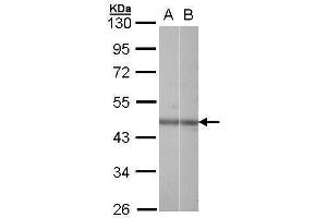 WB Image Sample (30 ug of whole cell lysate) A: Hela B: Raji 10% SDS PAGE antibody diluted at 1:1000 (NR2F6 抗体  (C-Term))