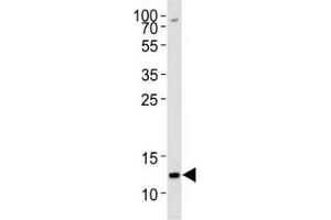Western Blotting (WB) image for anti-Histone Cluster 1, H4a (HIST1H4A) (meLys20) antibody (ABIN3031210)