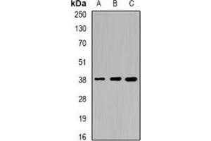 Western blot analysis of Sorbitol Dehydrogenase expression in HT29 (A), mouse liver (B), mouse kidney (C) whole cell lysates. (SORD 抗体)