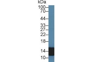 Detection of S100A8 in Human Leukocyte lysate using Polyclonal Antibody to S100 Calcium Binding Protein A8 (S100A8) (S100A8 抗体  (AA 1-89))