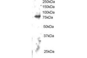 Western Blotting (WB) image for anti-Engulfment and Cell Motility 2 (ELMO2) (C-Term) antibody (ABIN2465647) (ELMO2 抗体  (C-Term))
