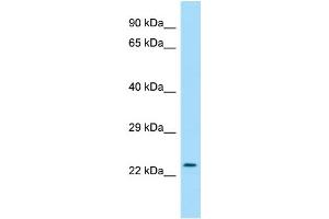 WB Suggested Anti-RAB30 Antibody Titration: 1. (RAB30 抗体  (C-Term))