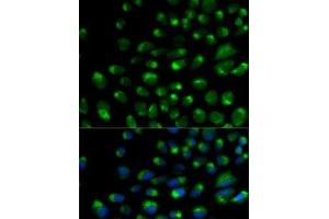 Immunofluorescence analysis of U2OS cells using IFNAR2 Polyclonal Antibody (IFNAR2 抗体)