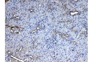 IHC analysis of CD151 using anti- CD151 antibody .