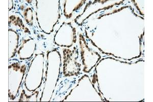 Immunohistochemical staining of paraffin-embedded Human pancreas tissue using anti-BDH2 mouse monoclonal antibody. (BDH2 抗体)
