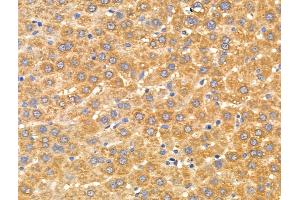 ABIN6256912 and ABIN6274865 at 1/100 staining Rat liver tissue by IHC-P. (Arylsulfatase A 抗体  (Internal Region))