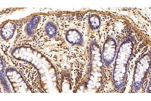 Detection of TXNIP in Human Colon Tissue using Polyclonal Antibody to Thioredoxin-interacting Protein (TXNIP) (TXNIP 抗体  (AA 32-367))
