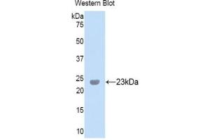 Detection of Recombinant PXDN, Human using Polyclonal Antibody to Peroxidasin Homolog (PXDN) (Peroxidasin 抗体  (AA 1285-1475))