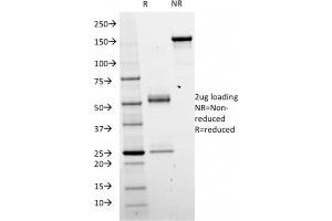 SDS-PAGE Analysis Purified Catenin beta Mouse Monoclonal Antibody (CTNNB1/2098).