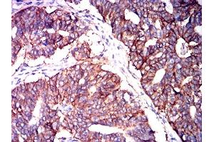 Immunohistochemistry (IHC) image for anti-Basigin (Ok Blood Group) (BSG) (AA 138-323) antibody (ABIN7193669)