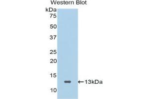 Western blot analysis of the recombinant protein. (SFRP4 抗体  (AA 265-346))
