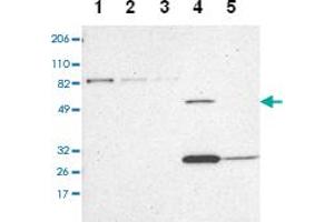 Western blot analysis of Lane 1: RT-4, Lane 2: U-251 MG, Lane 3: A-431, Lane 4: Liver, Lane 5: Tonsil with ZNF75A polyclonal antibody at 1:100-1:250 dilution. (ZNF75A 抗体)